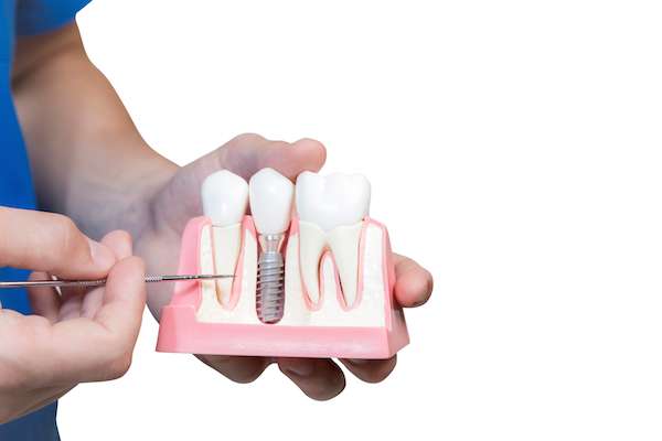 Can You Get Dental Implants if You Have Gum Disease from Elite Dental & Aesthetics in Plantation, FL