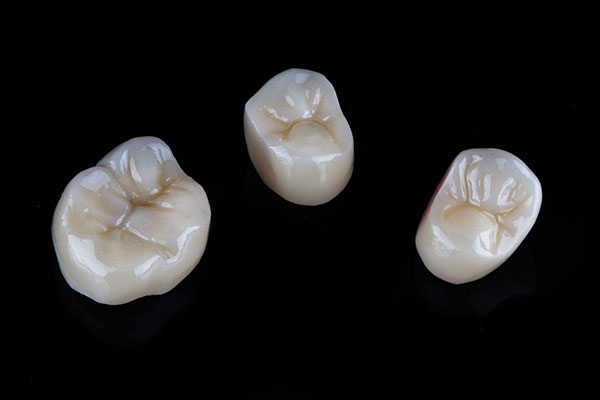 A Comparison of Dental Crown Materials from Elite Dental & Aesthetics in Plantation, FL