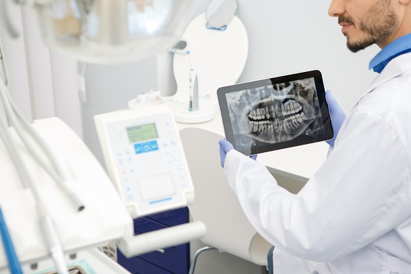 General Dentistry: Are Digital Dental X Rays Recommended?