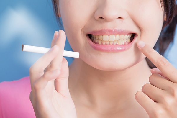 General Dentistry: How Smoking Can Harm Your Teeth from Elite Dental & Aesthetics in Plantation, FL