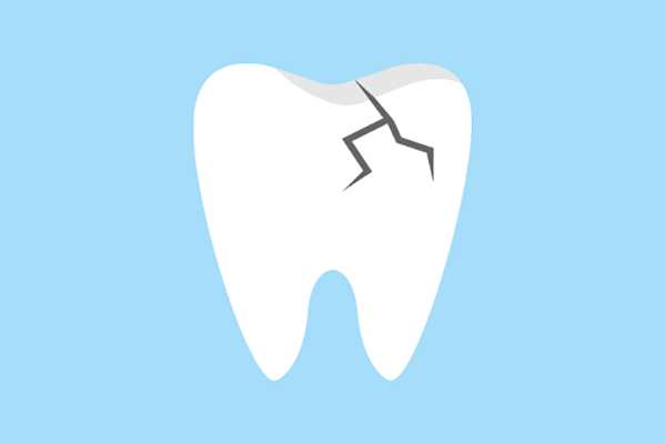 General Dentistry Treatments for a Damaged Tooth from Elite Dental & Aesthetics in Plantation, FL