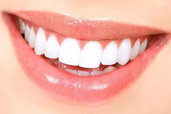 How Long Does Teeth Whitening Take from Elite Dental & Aesthetics in Plantation, FL