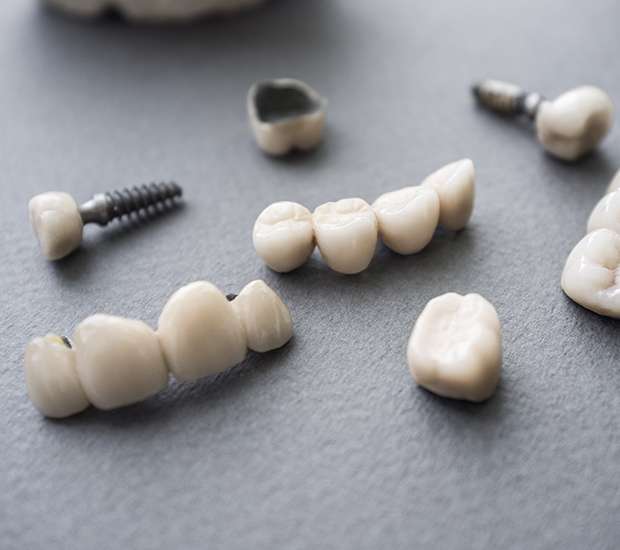 Plantation The Difference Between Dental Implants and Mini Dental Implants