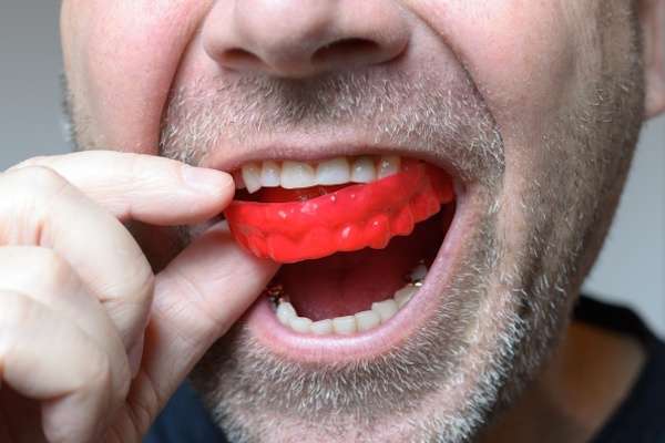 Save Your Teeth by Wearing Mouth Guards at Night from Elite Dental & Aesthetics in Plantation, FL