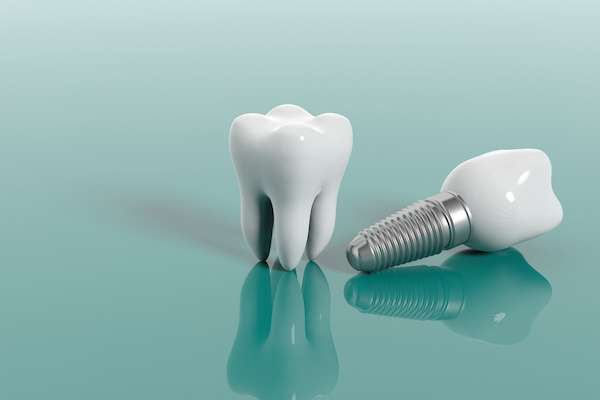 Multiple Teeth Replacement Options: One Implant for Two Teeth from Elite Dental & Aesthetics in Plantation, FL